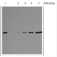 RPS1 | 30S ribosomal protein S1 in the group Antibodies Plant/Algal  / DNA/RNA/Cell Cycle / Translation at Agrisera AB (Antibodies for research) (AS08 309)
